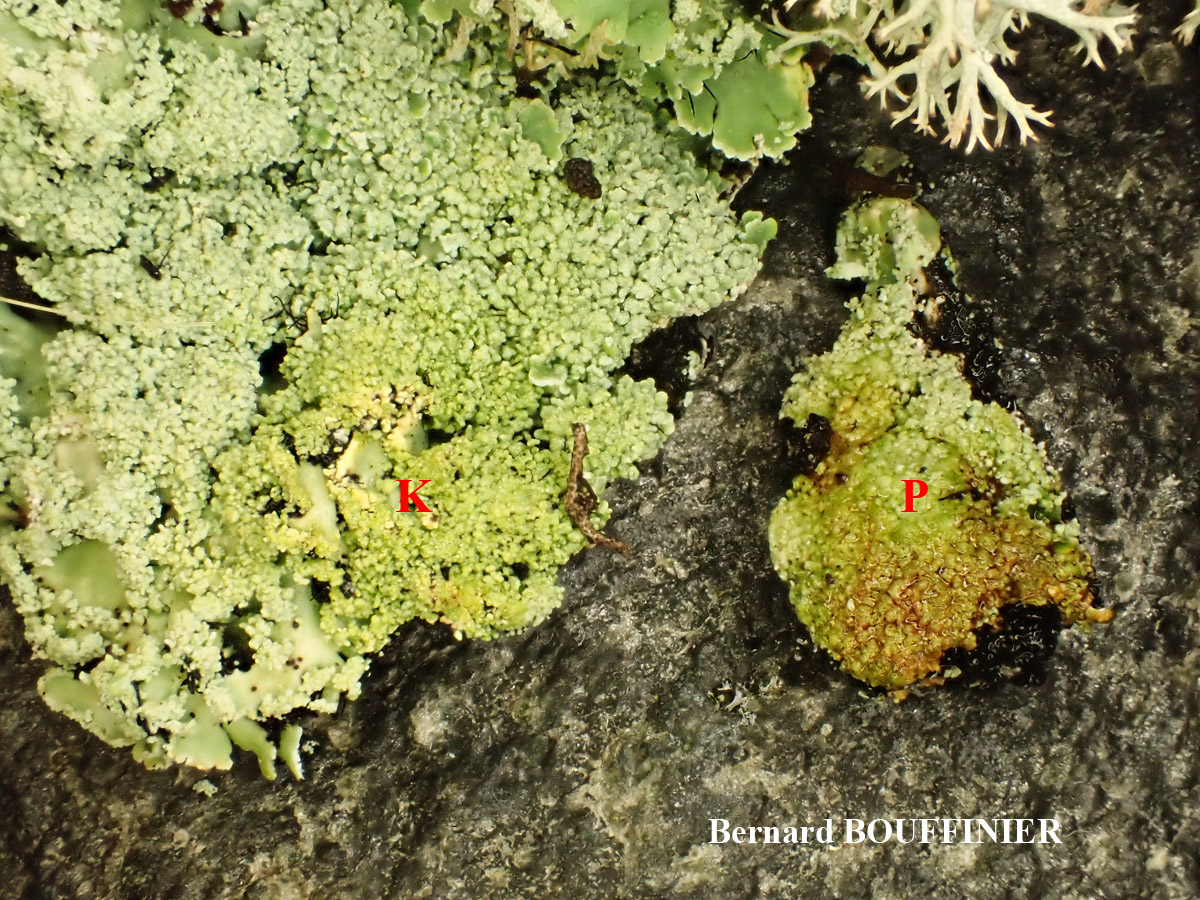 Heterodermia propagulifera (Vain.) J.P. Dey écomorph isidié-sorédié (blastidié). Séquencé.